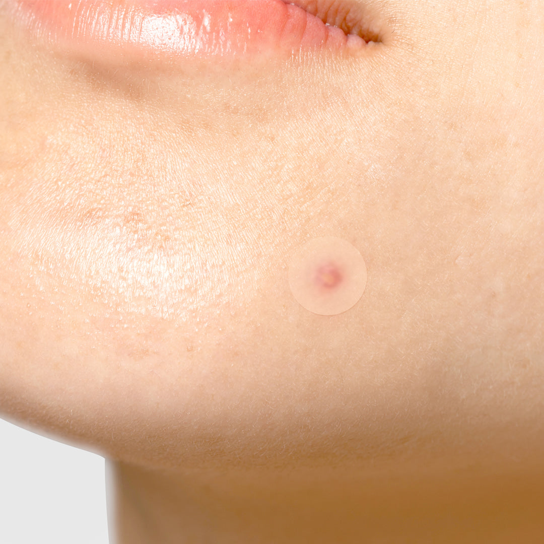 TIA'M Surprise B Patch