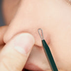 PyunkangYul Pimple Extractor PyunkangYul