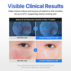 Centellian24 Madeca Cream Hydra Calming 50ml