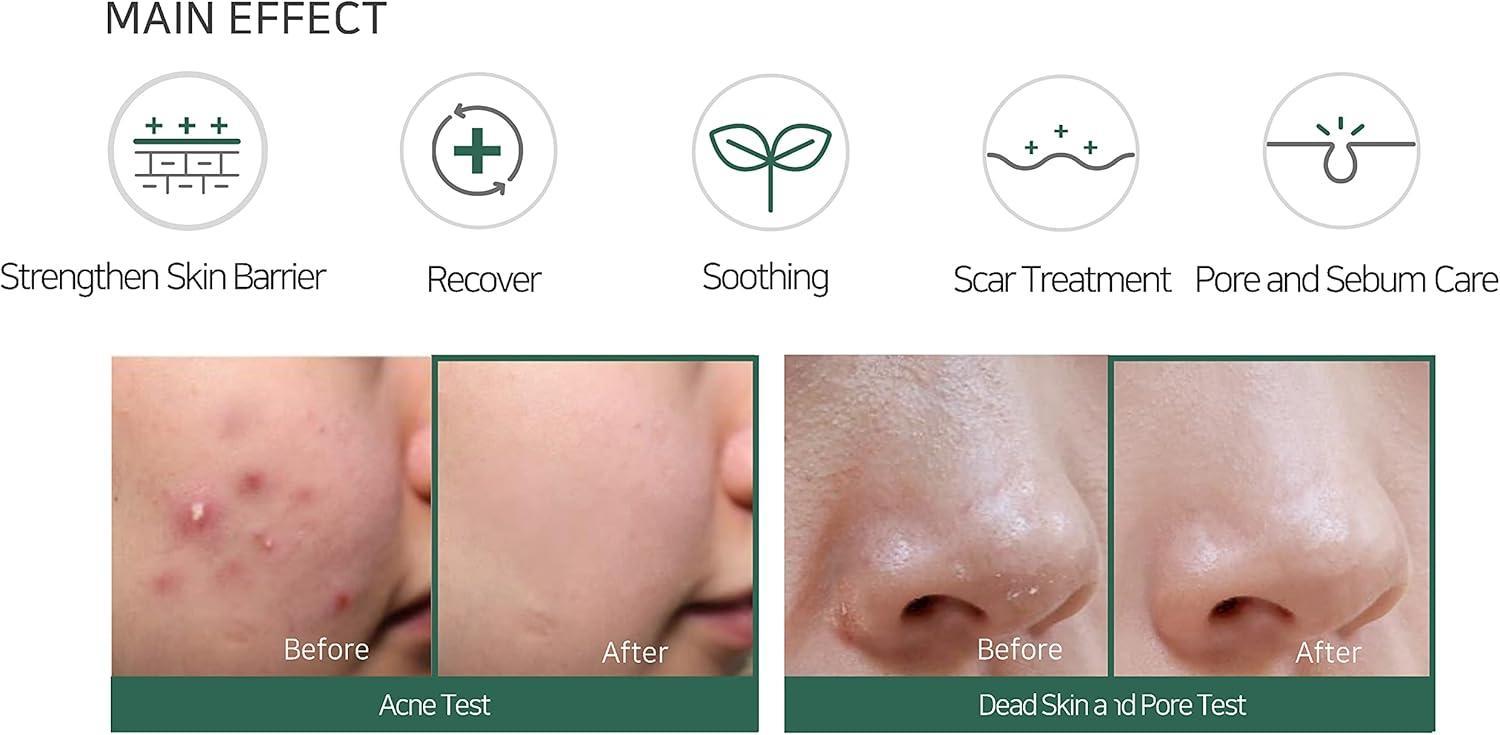 AHA BHA PHA cream for clearer and smoother looking skin