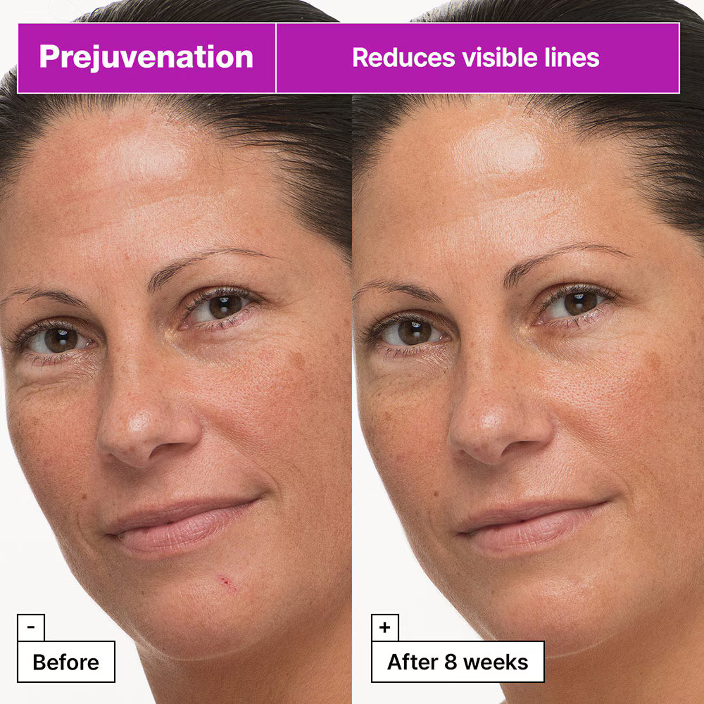 Anti aging moisturizer with bakuchiol and collagen peptides