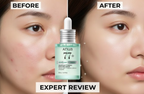 Anua serum med 77 procent heartleaf för glow och hudbarriär