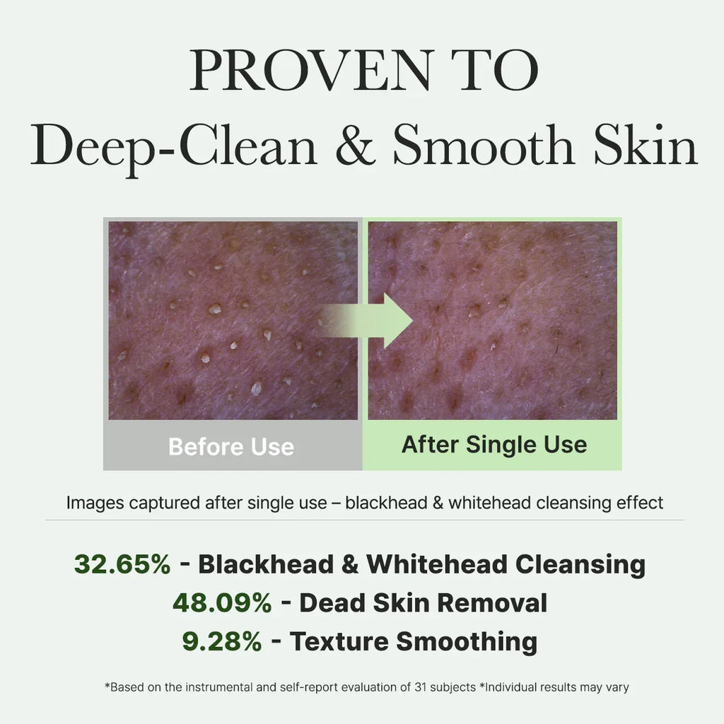 Arencia Fresh Green Rice Mochi Cleanser 120ml – K-beauty rengöring mot pormaskar och talg