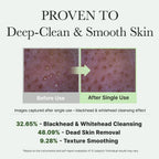 Arencia Fresh Green Rice Mochi Cleanser 120ml – K-beauty rengöring mot pormaskar och talg