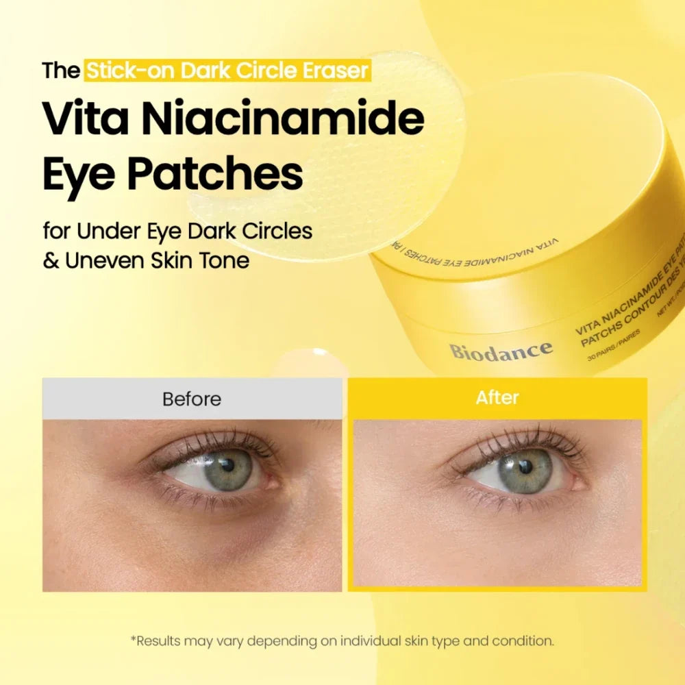 Before and after using Biodance Vita Niacinamide Eye Patches