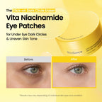 Before and after using Biodance Vita Niacinamide Eye Patches