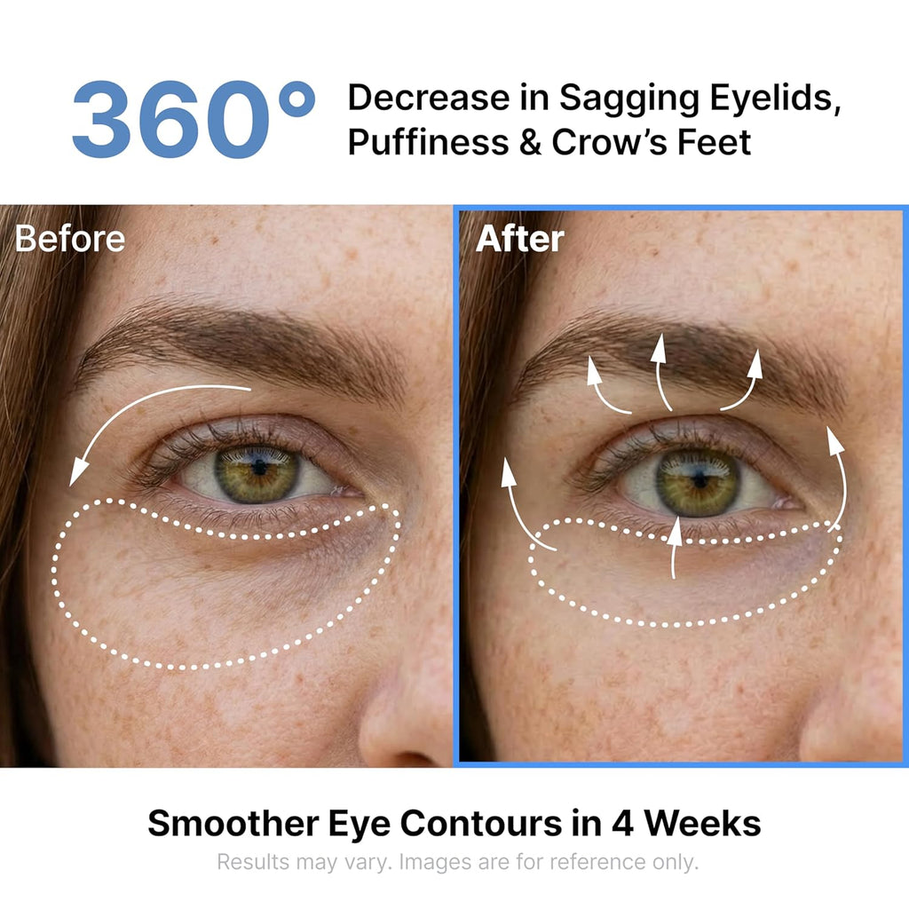 Ceramide eye cream for hydration and skin barrier support