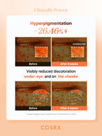 Eye patches med vitamin C och glutation för mer lyster
