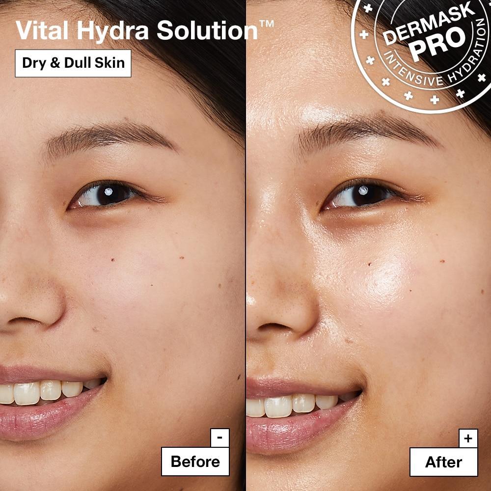 Dr.Jart+ Vital Hydra Solution sheet mask applied on face for deep hydration