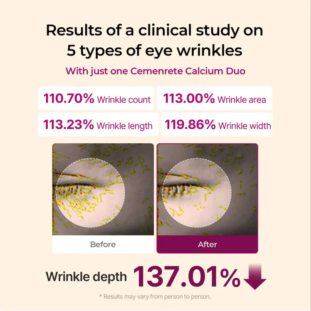 Eye wrinkle results with Dr.Melaxin Calcium Multi Balm