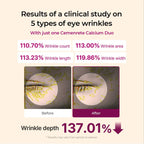 Eye wrinkle results with Dr.Melaxin Calcium Multi Balm