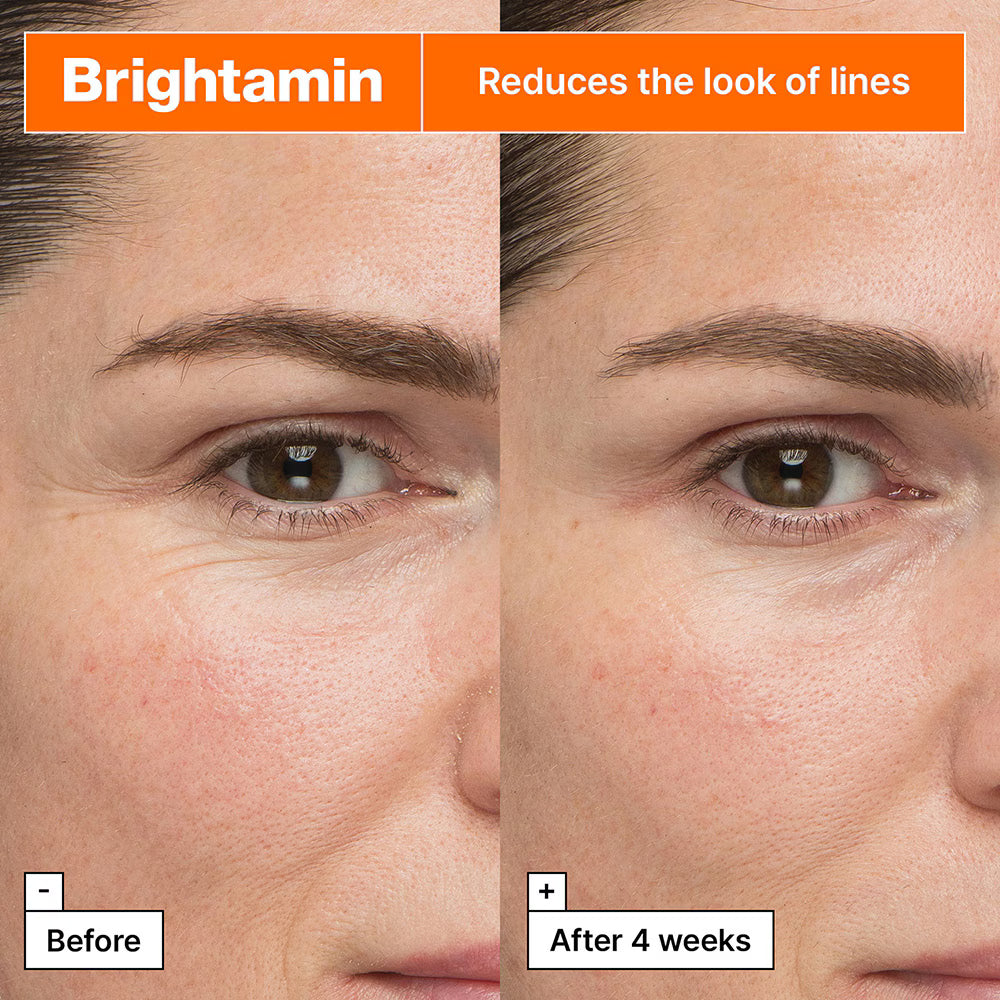Korean Vitamin C serum for pigmentation and radiant skin