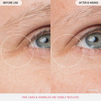 Before and after using Laneige Eye Sleeping Mask