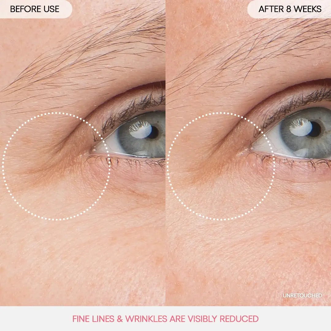 Before and after using Laneige Eye Sleeping Mask