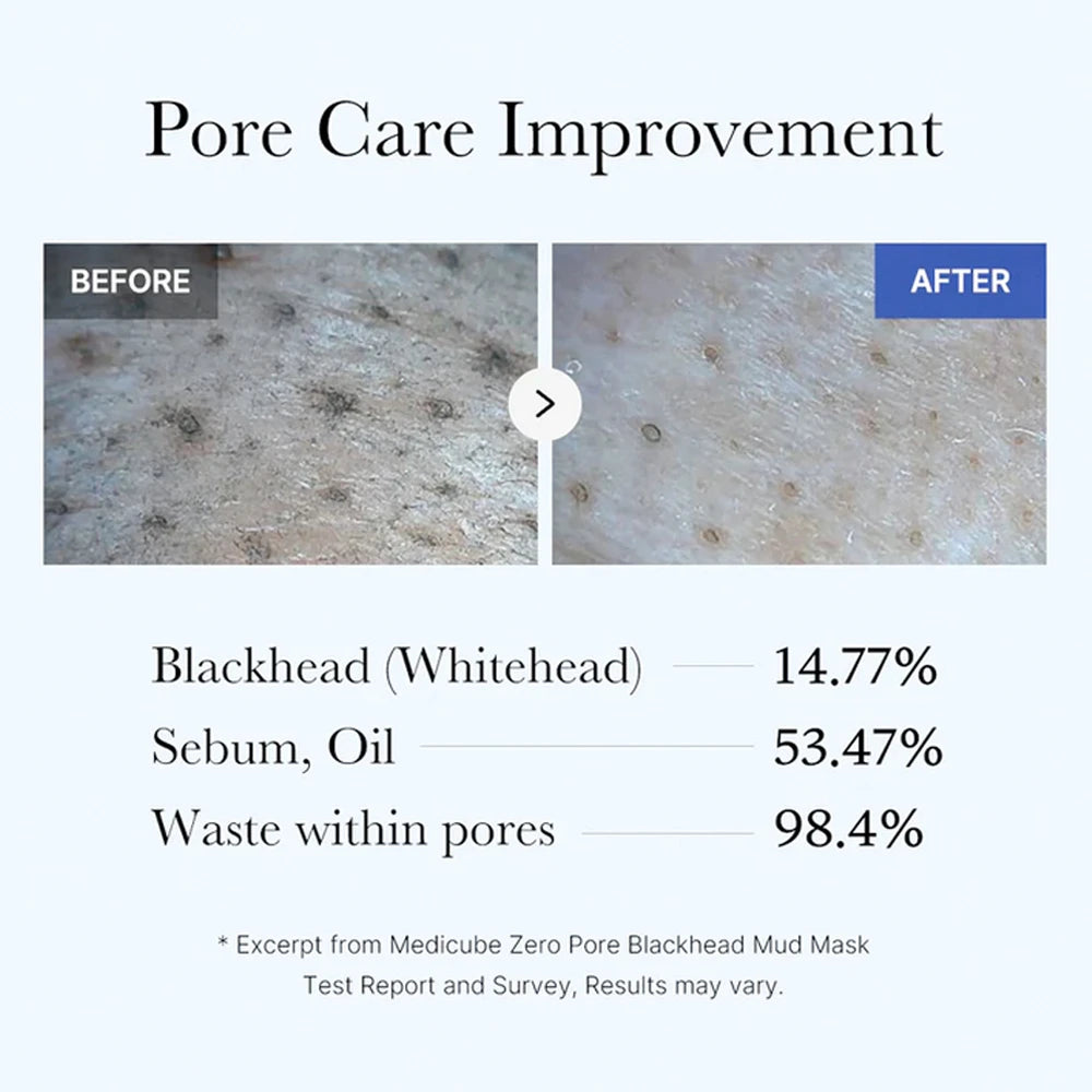 Så använder du Medicube Blackhead Mud Mask
