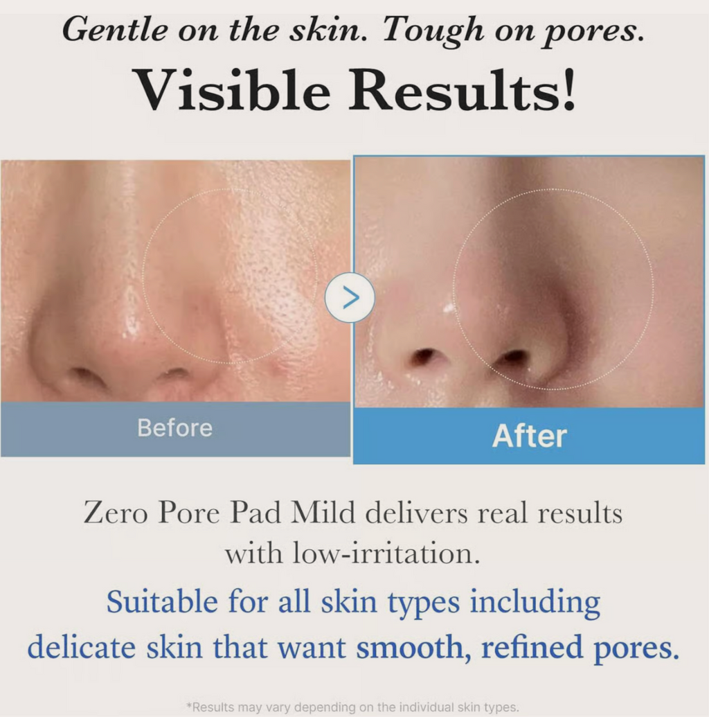 Fördelar med Medicube Zero Pore Pad Mild