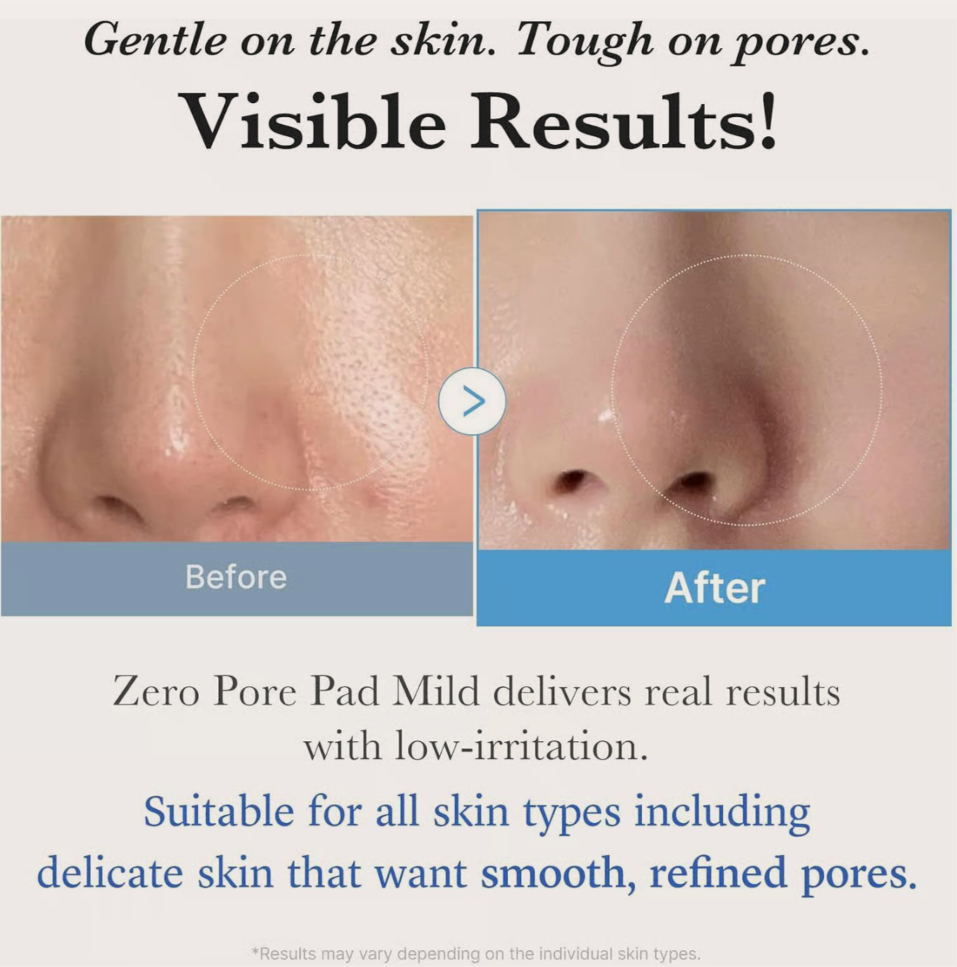 Fördelar med Medicube Zero Pore Pad Mild