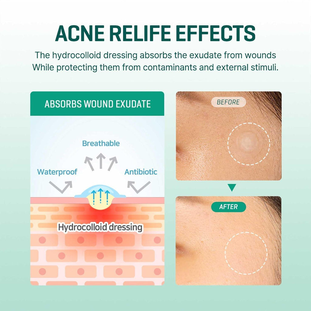 Transparent spot patch for acne prone skin